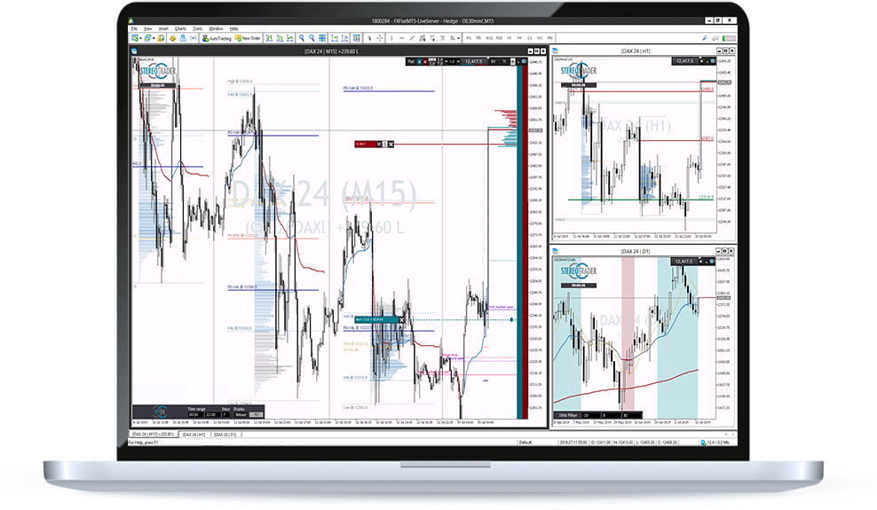 Laptop MetaTrader AddOns StereoTrader Laptop MetaTrader AddOns StereoTrader